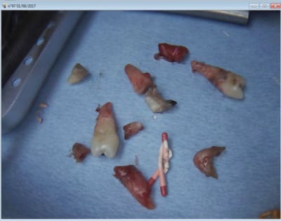 Capture d écran 2017 07 14 07.25 - Eugenol