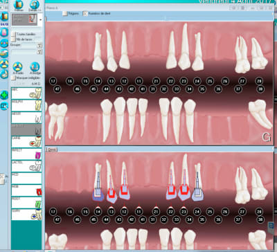 Capture d écran 2017 08 04 12.10 - Eugenol