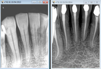 Capture d e cran 2015 02 09 10.00 - Eugenol