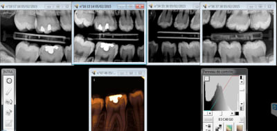Capture d e cran 2015 02 24 09.14 - Eugenol