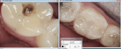 Capture d e cran 2016 01 18 10.33 - Eugenol