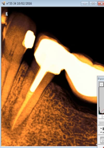 Capture d e cran 2016 02 10 10.05 - Eugenol