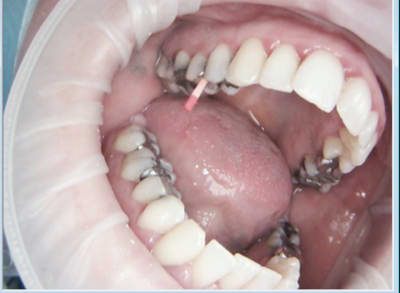 Capture d e cran 2016 02 11 09.08 - Eugenol