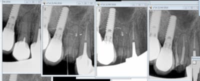 Capture d e cran 2016 04 21 12.17 - Eugenol