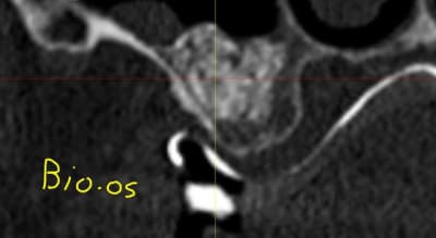 Capture gawpu3 - Eugenol
