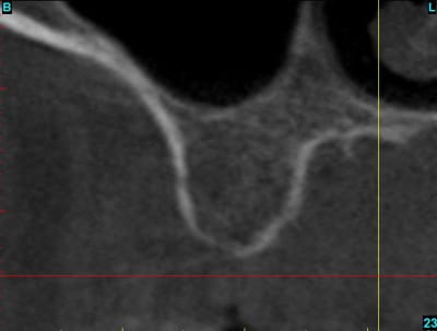 Capture wil evptam - Eugenol