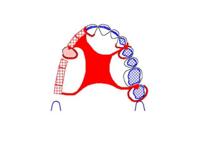 Casbenibi wc6ctp - Eugenol