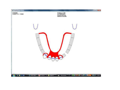Cas 1 trac  qfm6f2 - Eugenol