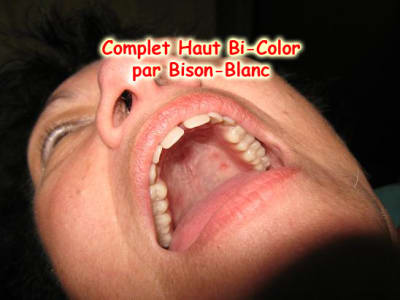 Complet bison blanc  3  oklxdp - Eugenol