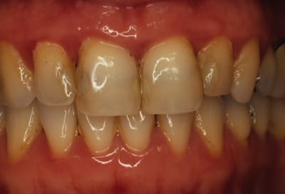 Copie de avt brossage zee5jn - Eugenol