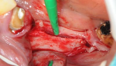 Copie de dsc 4044 xhqlfm - Eugenol