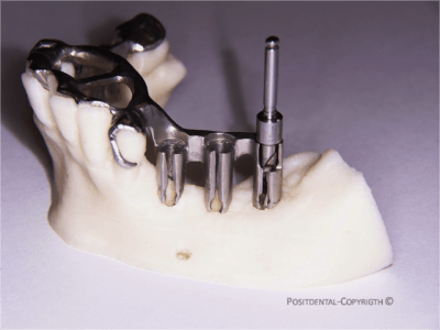 Copie de www.positdental - Eugenol