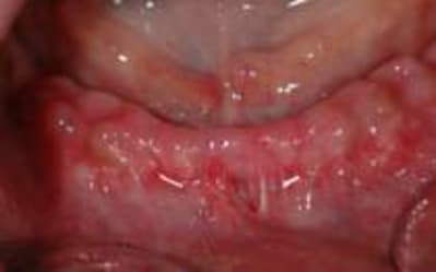 Copy of dsc 0032 mok1wt - Eugenol