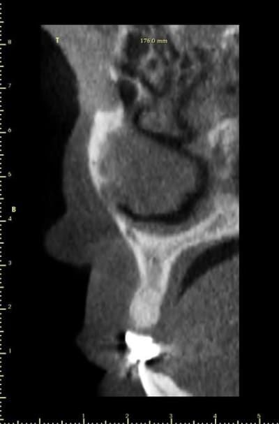 Coupe 3 iqzvit - Eugenol