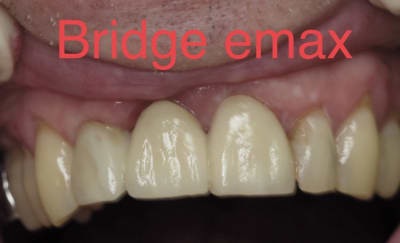 D278a3c7 e576 47f6 86be c6e6ff2c84d2 elkx4b - Eugenol