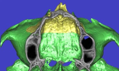 Dar3d8 jp61wr - Eugenol