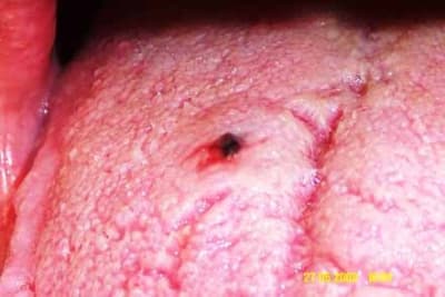 Dcp 0322 uewmal - Eugenol