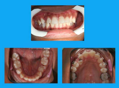 Debut 1 mc6nwi - Eugenol