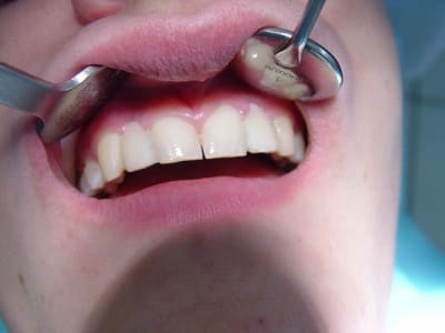 Dsc00085 ddh7ot - Eugenol