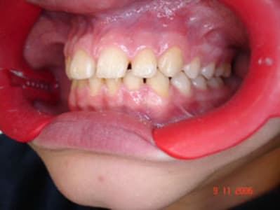 Dsc00926 nj4c0x - Eugenol