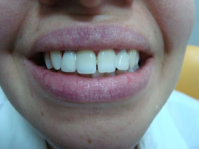 Dsc02850 csr3et - Eugenol