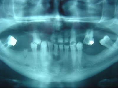 Dsc02892 aclkwv - Eugenol