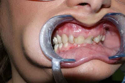 Dsc03299  1  qdgudt - Eugenol