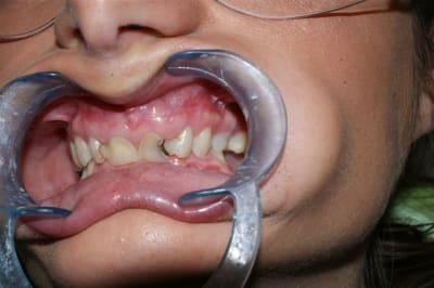 Dsc03300  1  dv3tjt - Eugenol