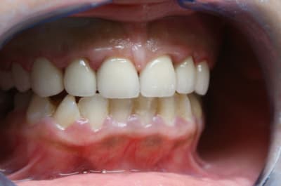 Dsc03388 fsmi4p - Eugenol