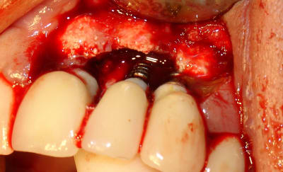 Dsc07986 hftf2q - Eugenol
