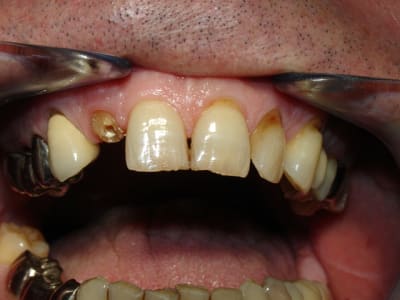 Dsc09759 eoqj3s - Eugenol