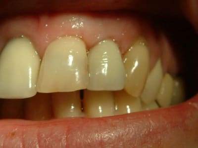 Dscf0098 bis orwb6n - Eugenol