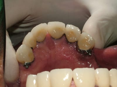 Dscf0628 v1148p - Eugenol