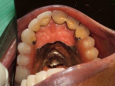 Dscf0631 mmvstc - Eugenol