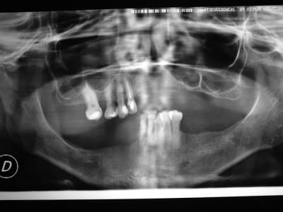 Dscf1301 edhrwg - Eugenol