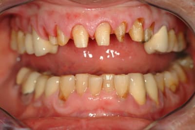 Dscf1468 kz9vnx - Eugenol