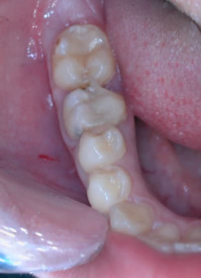 Dscn0339 zbzs6n - Eugenol