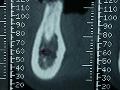 Dscn0390 copie ubaahk - Eugenol