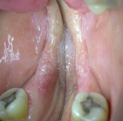 Dscn1046 qgjnj0 - Eugenol