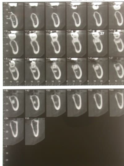 Dscn1715 crfl0n - Eugenol