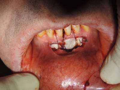 Dscn1874 lzgczs - Eugenol