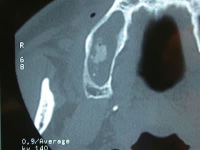 Dscn2066 udphnp - Eugenol