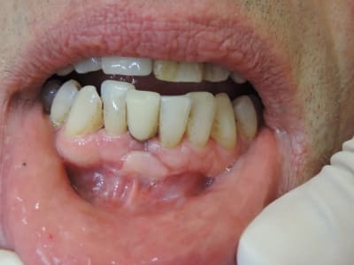 Dscn2450 dpakrd - Eugenol