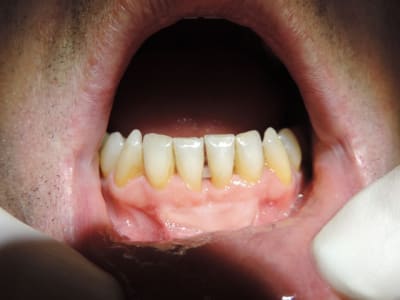 Dscn2459 czyv6r - Eugenol