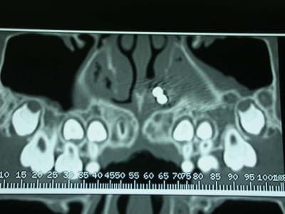 Dscn2556 zq9usn - Eugenol