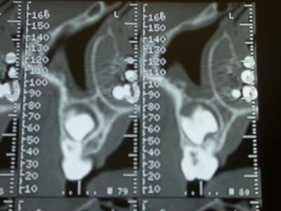 Dscn2562 ayd096 - Eugenol