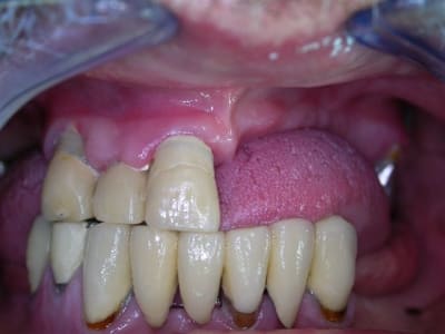 Dscn2601 crjpg9 - Eugenol
