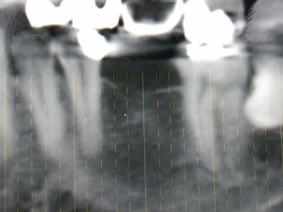 Dscn2834 tm0r3v - Eugenol