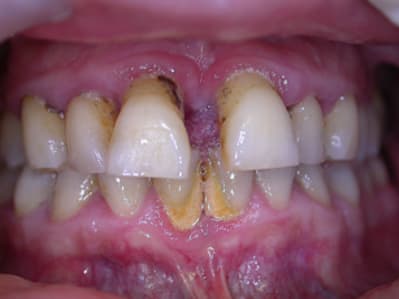 Dscn3426a wrtxqx - Eugenol