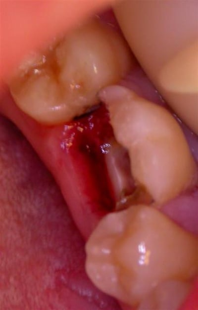 Dscn4338  large  eaymjt - Eugenol